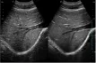 20200914091446640