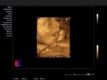fetal_imaging_3d_1800000003573100_f35eab2c3b4340a0a6f2e305e7b3e148_compact