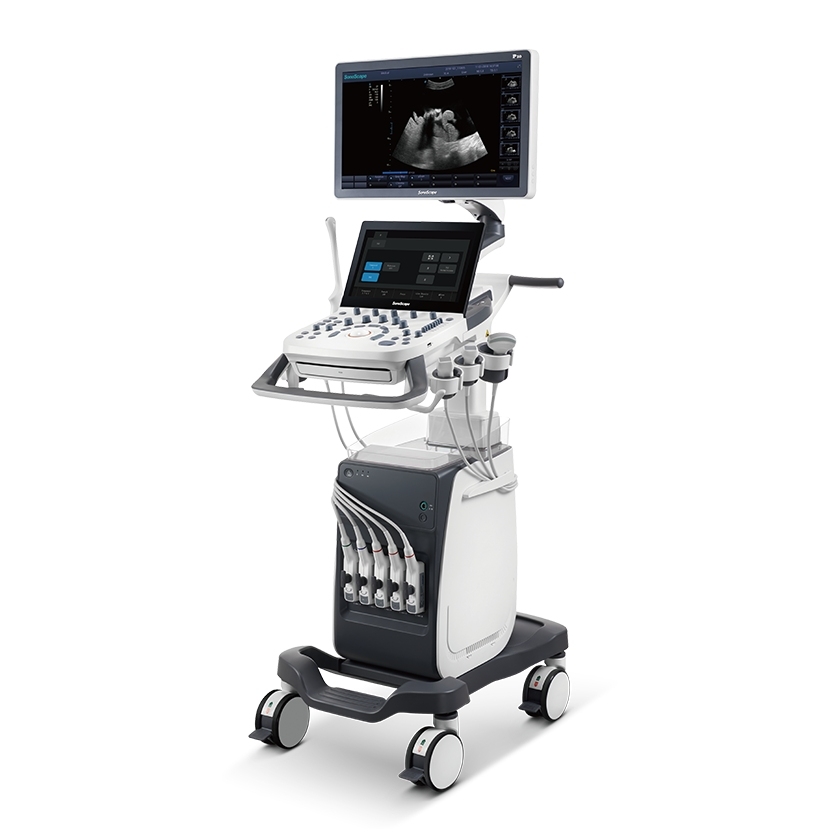 MÁY SIÊU ÂM TỔNG QUÁT P10 SonoScape