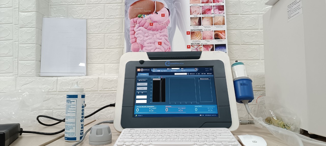 MÁY SIÊU ÂM ĐỊNH LƯỢNG ĐÀN HỒI MÔ GAN