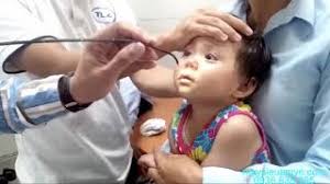 Máy nội soi tai mũi họng ống mền PenTax ThăngLongMedical độc