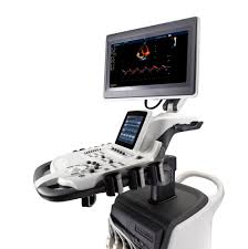 Máy siêu âm 4D Doppler màu S40 SonoScape Italy Công Ty TNHH