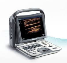 Máy siêu âm 2d Sonoscape xách tay A5 có phủ màu