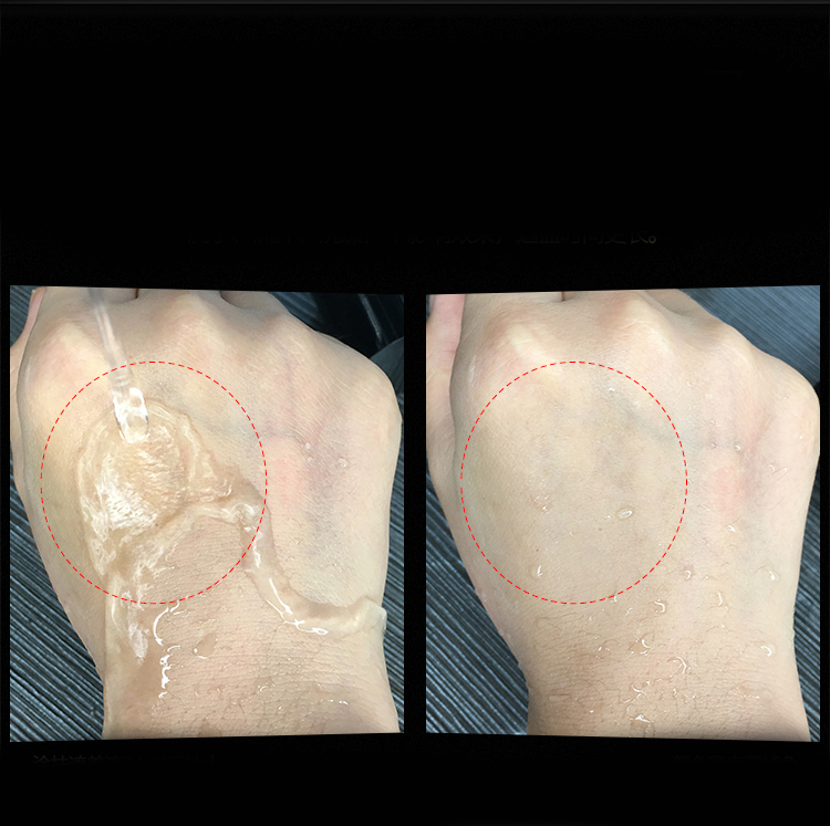 siêu kem che khuyết điểm bạch biến super vitiligo đẹp mãi ddddd