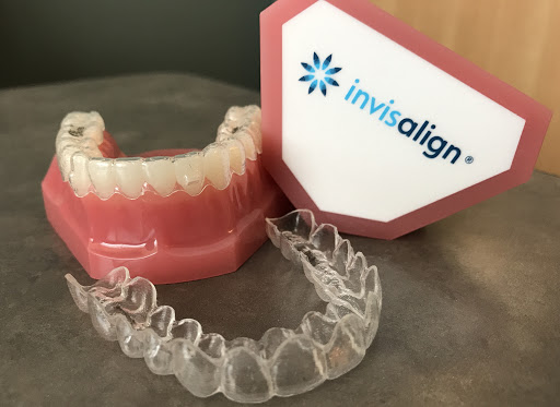 Niềng răng Invisalign là gì?