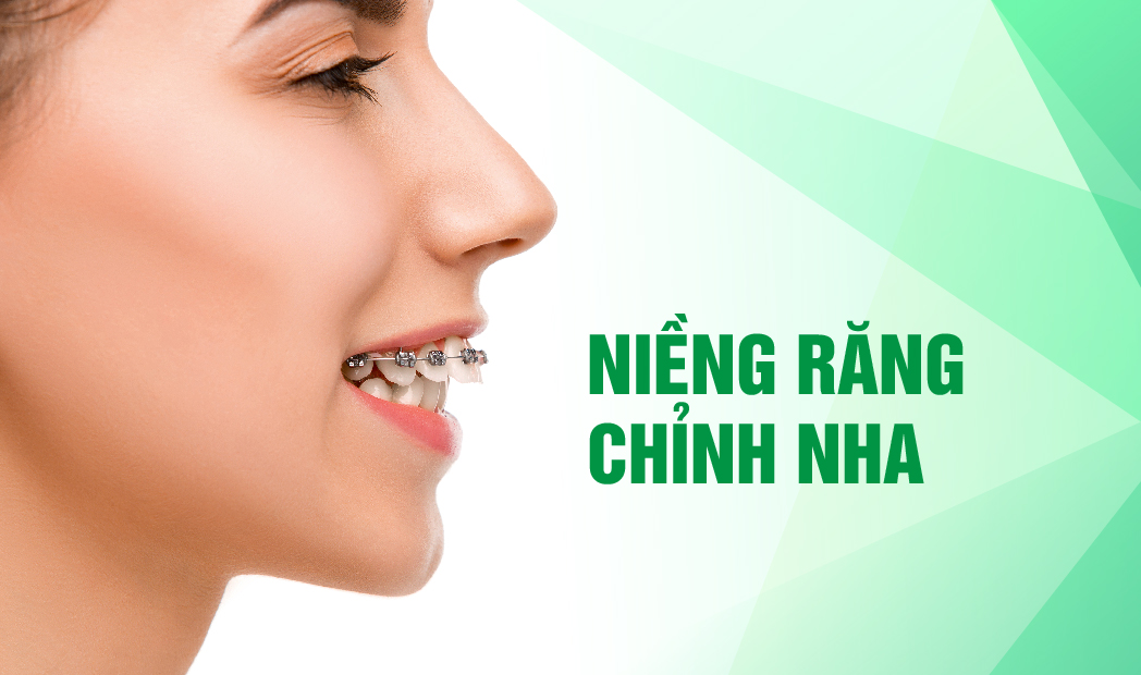 NIỀNG RĂNG GIẢI PHÁP KHẮC PHỤC HÔ - THƯA - MÓM - KHẤP KHỂNH