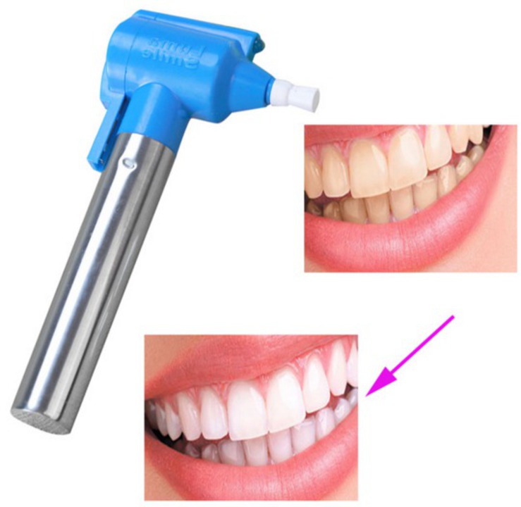 LUMA SMILE MÁY LÀM TRẮNG RĂNG, MANG ĐẾN NỤ CƯỜI TƯƠI SÁNG