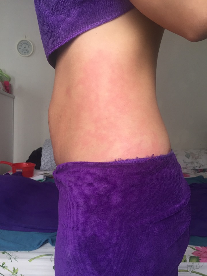 phuc-hoi-toan-dien-evacare-1