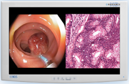 Medical FHD Endoscope Monitor 24"