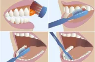 Chải răng đúng cách