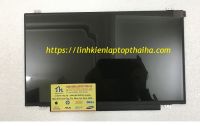 Nguyên nhân và cách khắc phục lỗi đen màn hình laptop lenovo