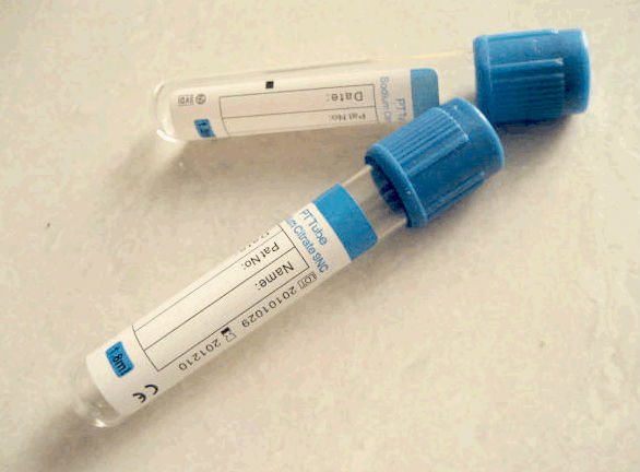 ống nghiệm trong xét nghiệm lâm sàng