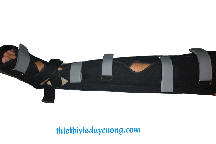 Nẹp chống xoay dài